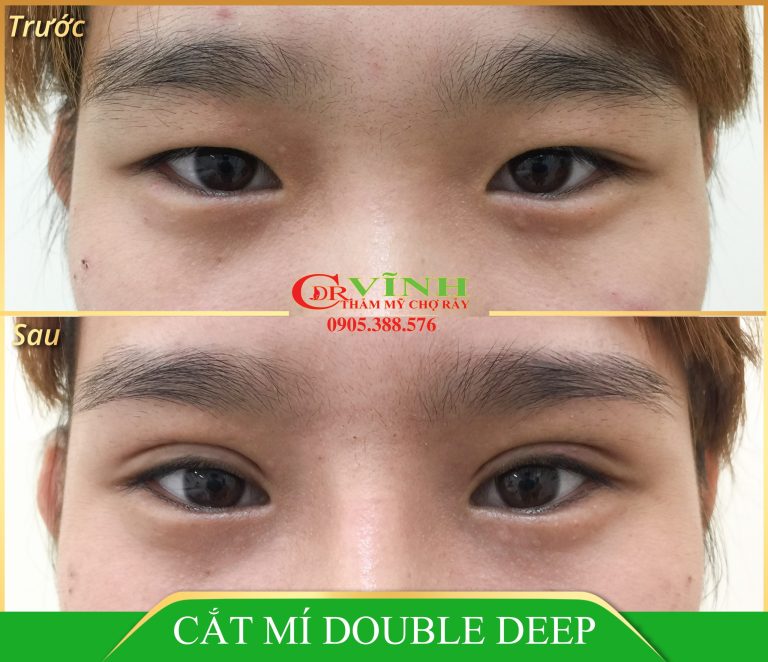 CAT-MAT-DOUBLE-DEEP-1-scaled.jpg