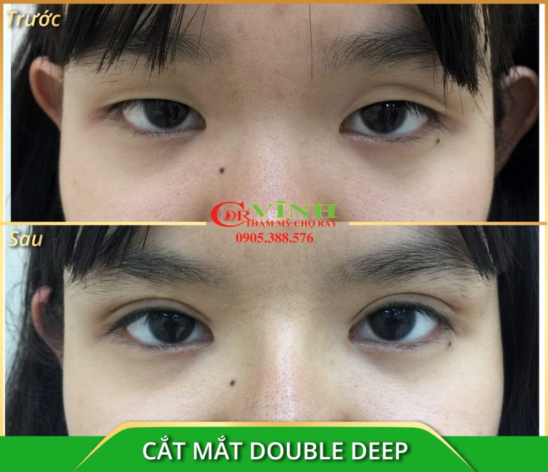 cat-mat-double-deep-Copy2-scaled.jpg