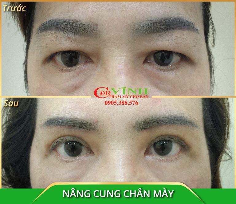 nang-cung-chan-may-scaled.jpg
