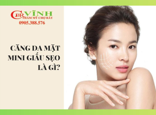 Căng đa mặt mini