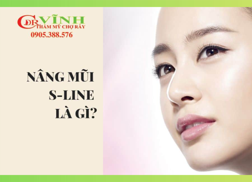 nâng mũi S-line