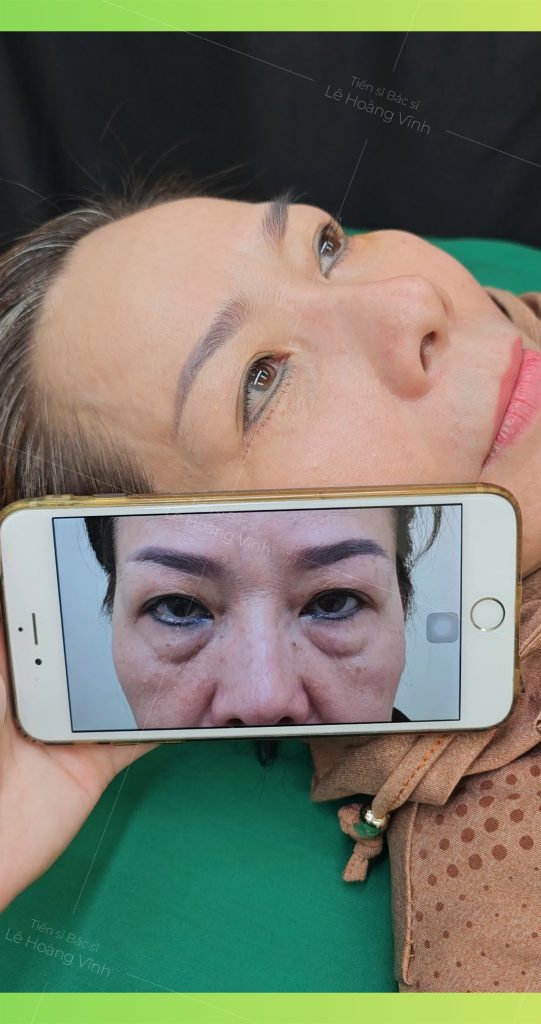 cat-mi-duoi-tai-phong-kham-phau-thuat-tham-my