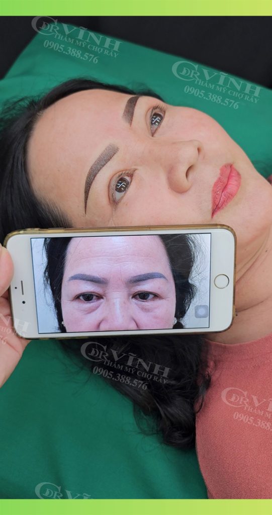 nang-cung-chan-may-phong-kham-phau-thuat-tham-my-2