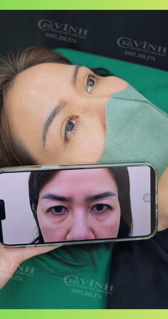 nang-cung-chan-may-phong-kham-phau-thuat-tham-my