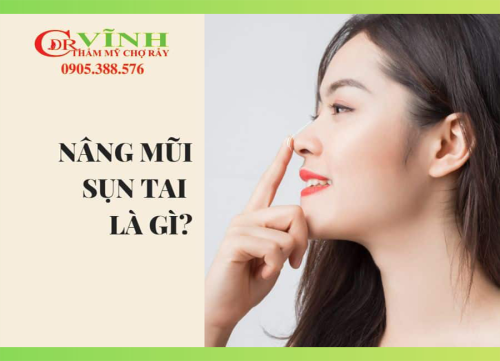nâng mũi sụn tai