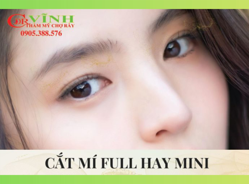 cắt mí full hay mini