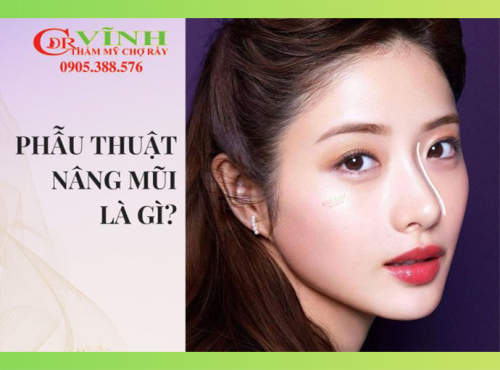 Nâng mũi bệnh viện Chợ rẫy