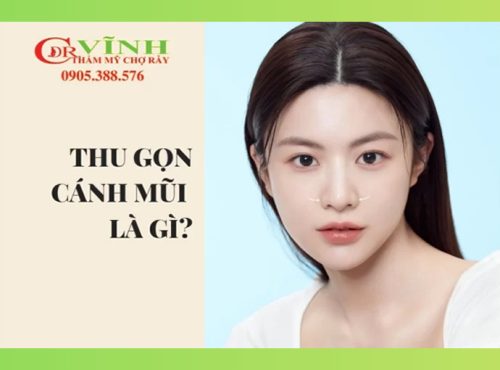 thu gọn cánh mũi