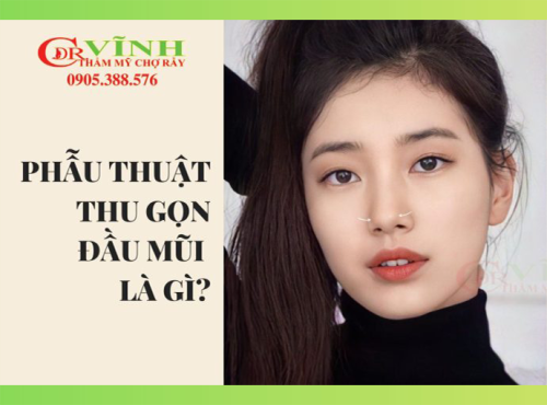 thu gọn đầu mũi