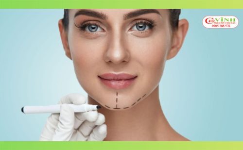 độn cằm giữ được bao lâu